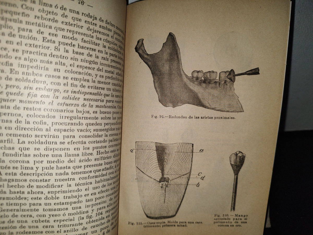 59- Antiguo Libro De Odontología: Atlas Y Tratado De Prótesis Dental Y Bucal - Gustavo Preiswerk - Madrid, Librería Académica, 1923