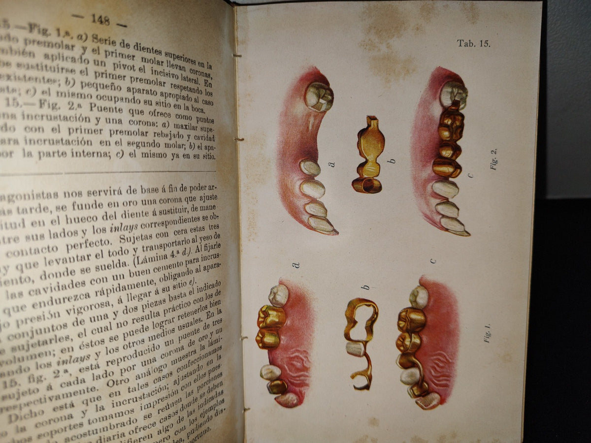 59- Antiguo Libro De Odontología: Atlas Y Tratado De Prótesis Dental Y Bucal - Gustavo Preiswerk - Madrid, Librería Académica, 1923