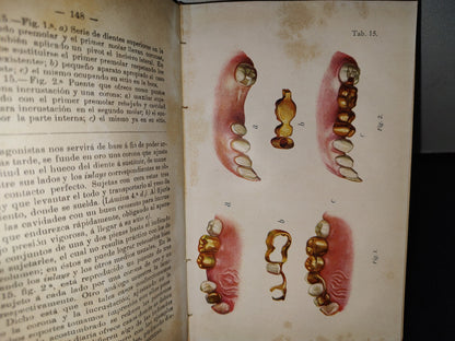 59- Antiguo Libro De Odontología: Atlas Y Tratado De Prótesis Dental Y Bucal - Gustavo Preiswerk - Madrid, Librería Académica, 1923