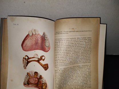 59- Antiguo Libro De Odontología: Atlas Y Tratado De Prótesis Dental Y Bucal - Gustavo Preiswerk - Madrid, Librería Académica, 1923