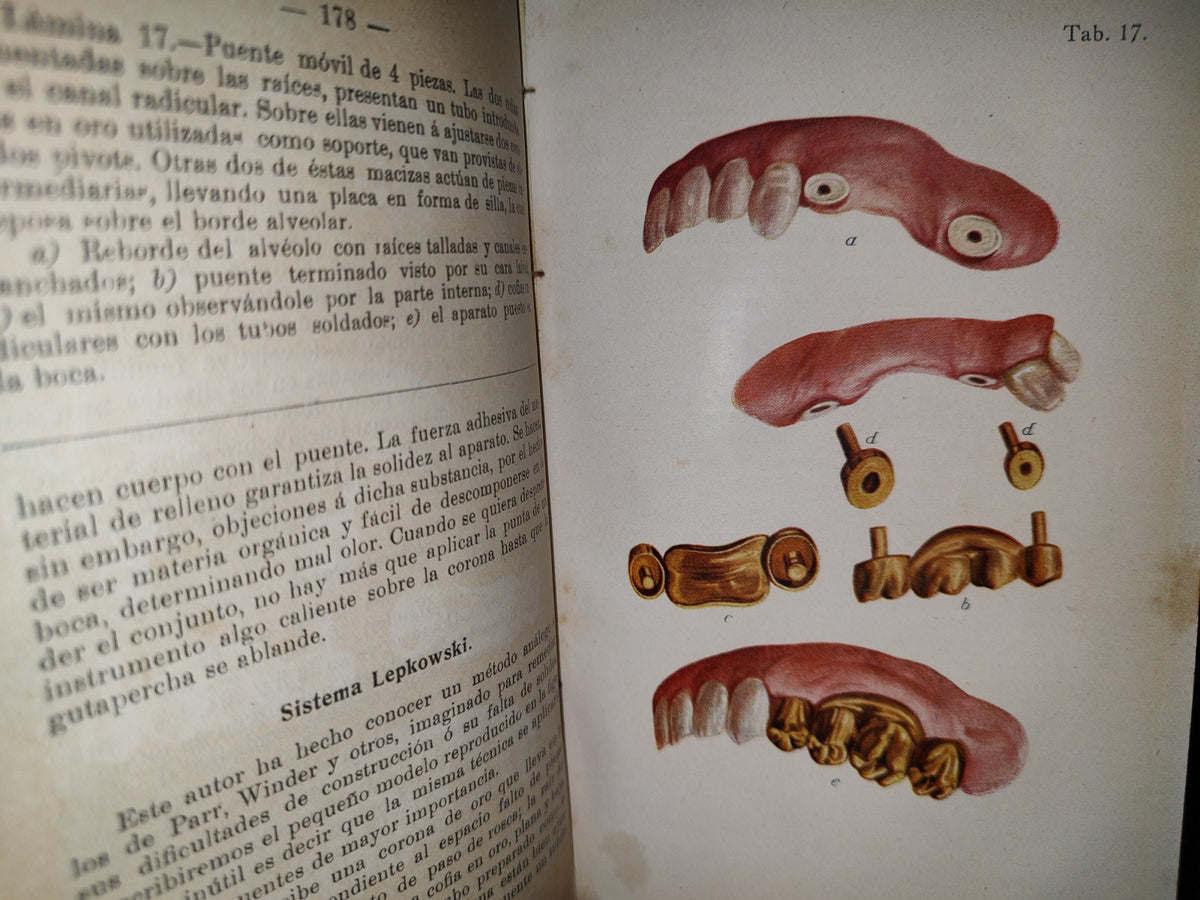 59- Antiguo Libro De Odontología: Atlas Y Tratado De Prótesis Dental Y Bucal - Gustavo Preiswerk - Madrid, Librería Académica, 1923