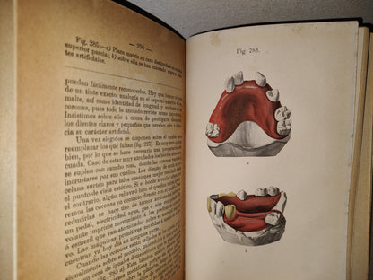 59- Antiguo Libro De Odontología: Atlas Y Tratado De Prótesis Dental Y Bucal - Gustavo Preiswerk - Madrid, Librería Académica, 1923