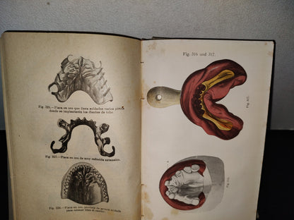 59- Antiguo Libro De Odontología: Atlas Y Tratado De Prótesis Dental Y Bucal - Gustavo Preiswerk - Madrid, Librería Académica, 1923