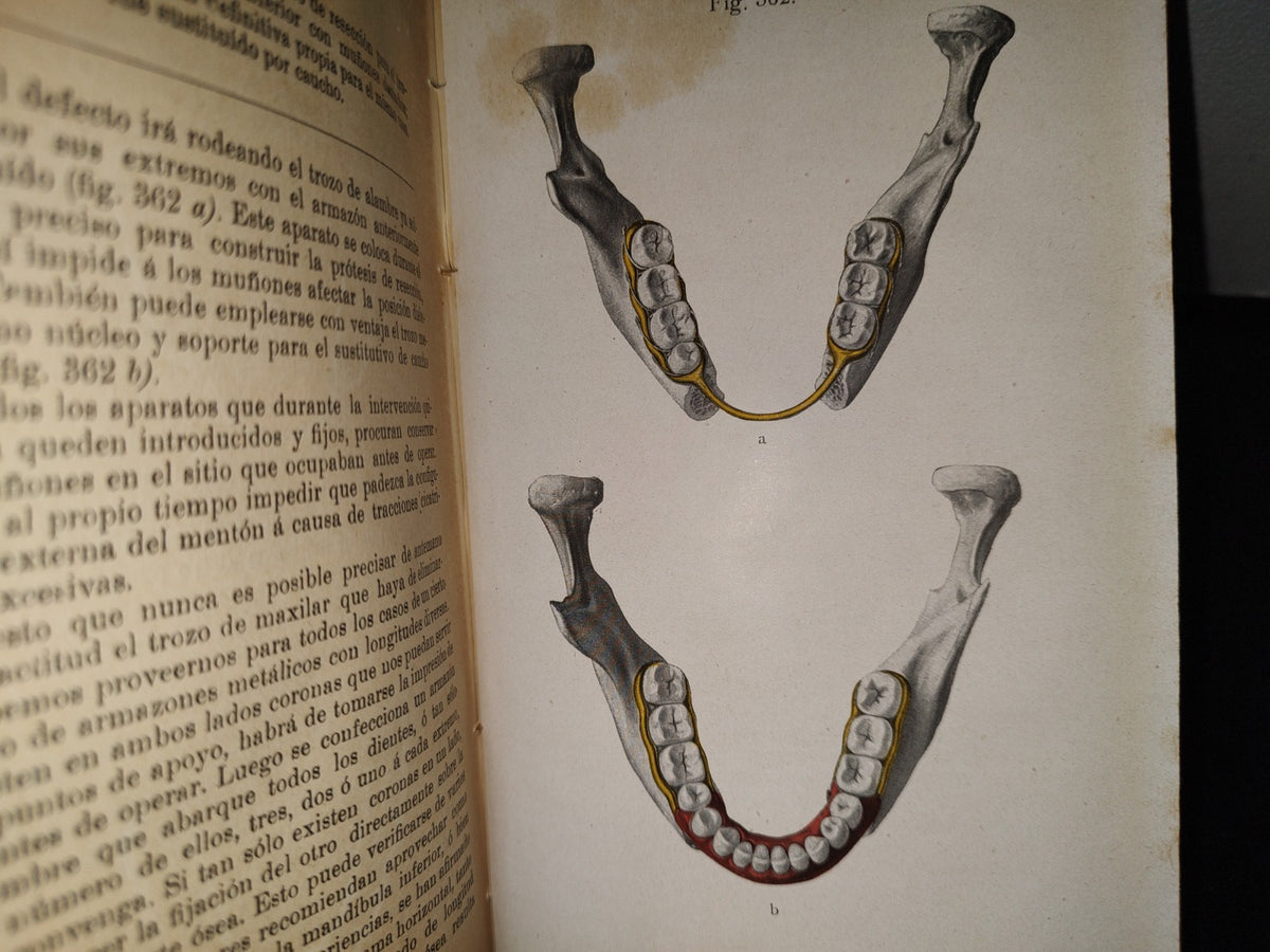 59- Antiguo Libro De Odontología: Atlas Y Tratado De Prótesis Dental Y Bucal - Gustavo Preiswerk - Madrid, Librería Académica, 1923