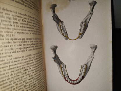 59- Antiguo Libro De Odontología: Atlas Y Tratado De Prótesis Dental Y Bucal - Gustavo Preiswerk - Madrid, Librería Académica, 1923