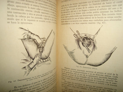 32- Manual De Obstetricia - José Rábago - 1965