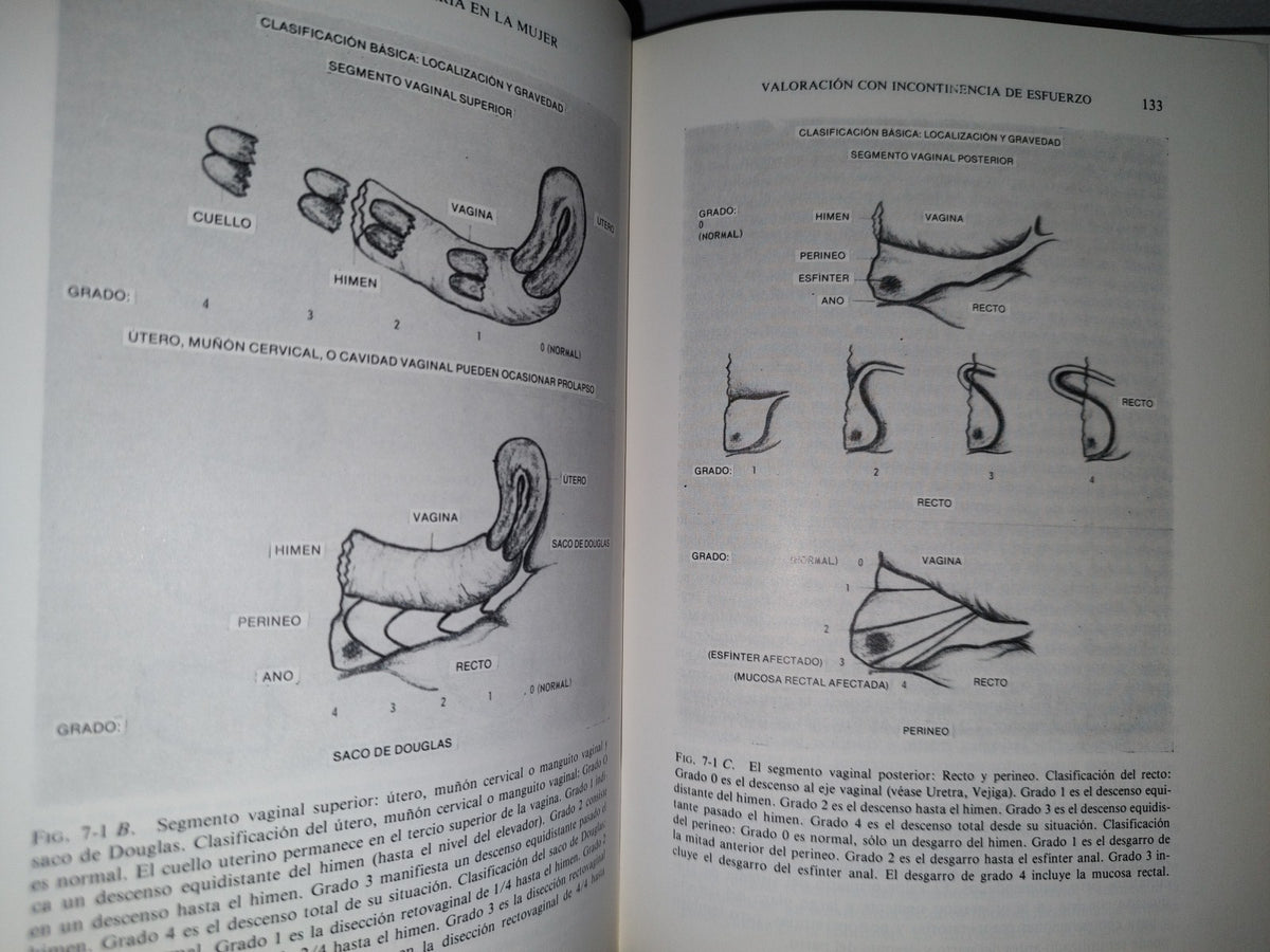 179- Incontinencia Urinaria En La Mujer - Edward B. Cantor - 1981