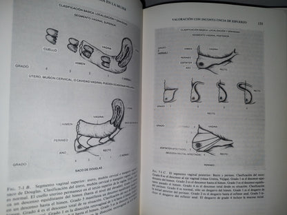179- Incontinencia Urinaria En La Mujer - Edward B. Cantor - 1981
