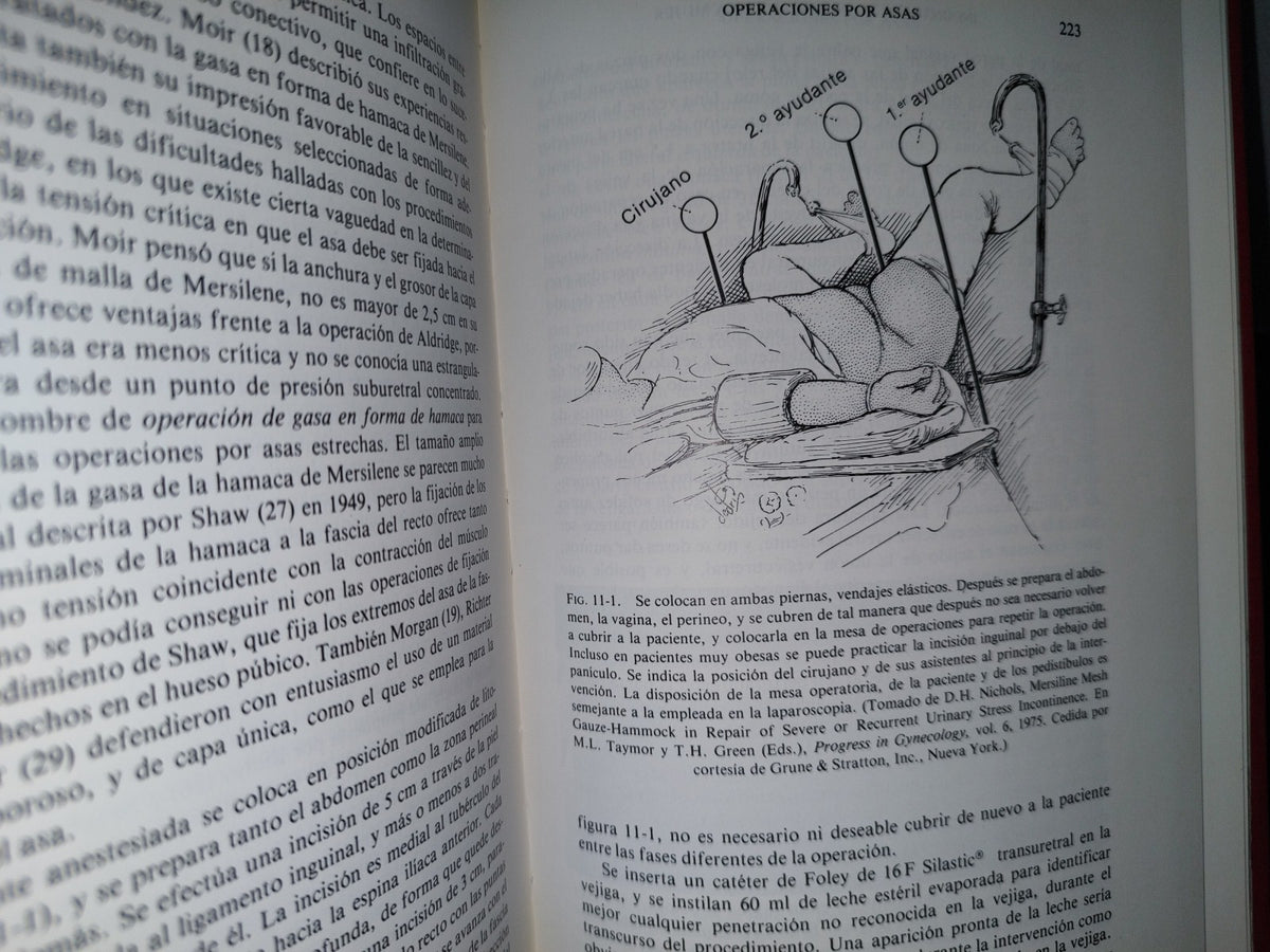 179- Incontinencia Urinaria En La Mujer - Edward B. Cantor - 1981