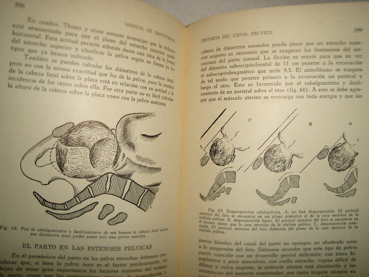 32- Manual De Obstetricia - José Rábago - 1965