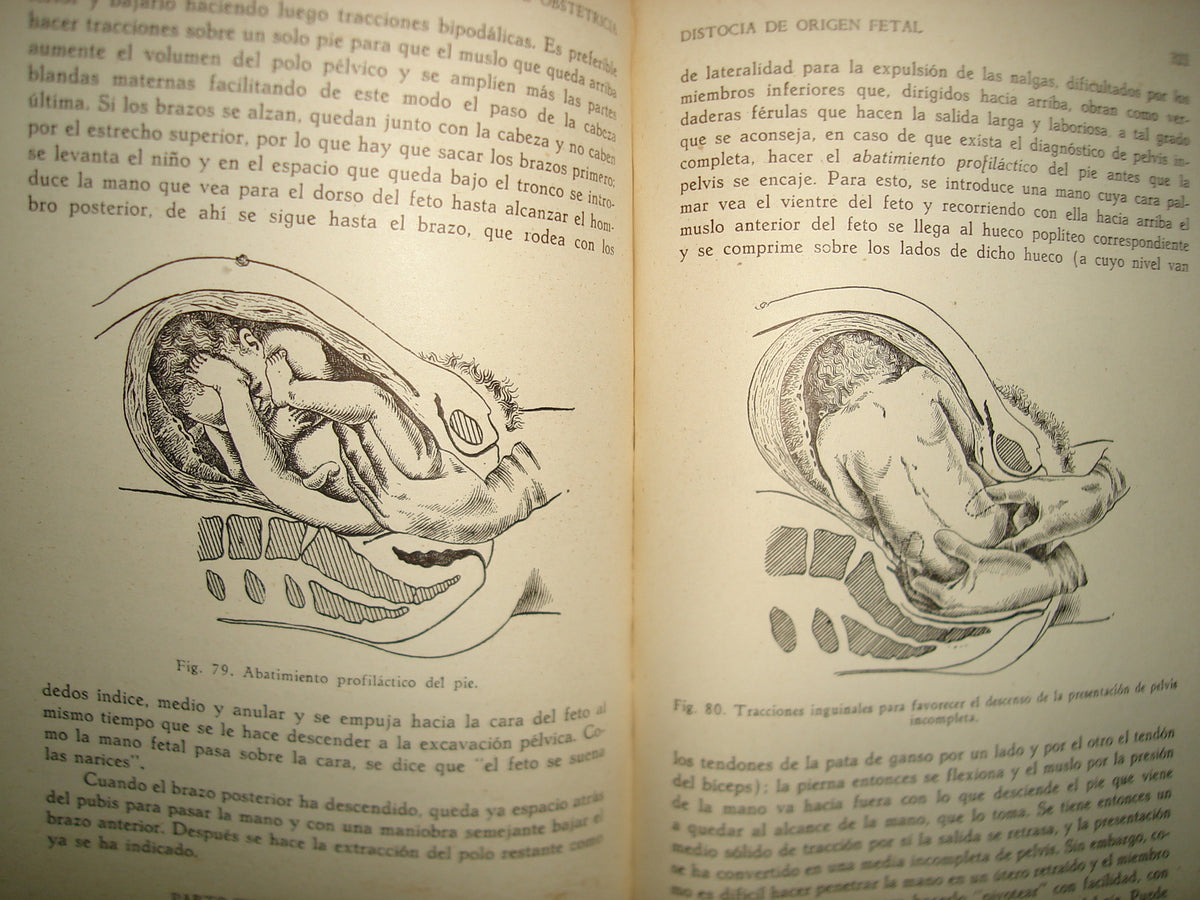 32- Manual De Obstetricia - José Rábago - 1965