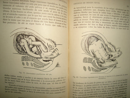 32- Manual De Obstetricia - José Rábago - 1965