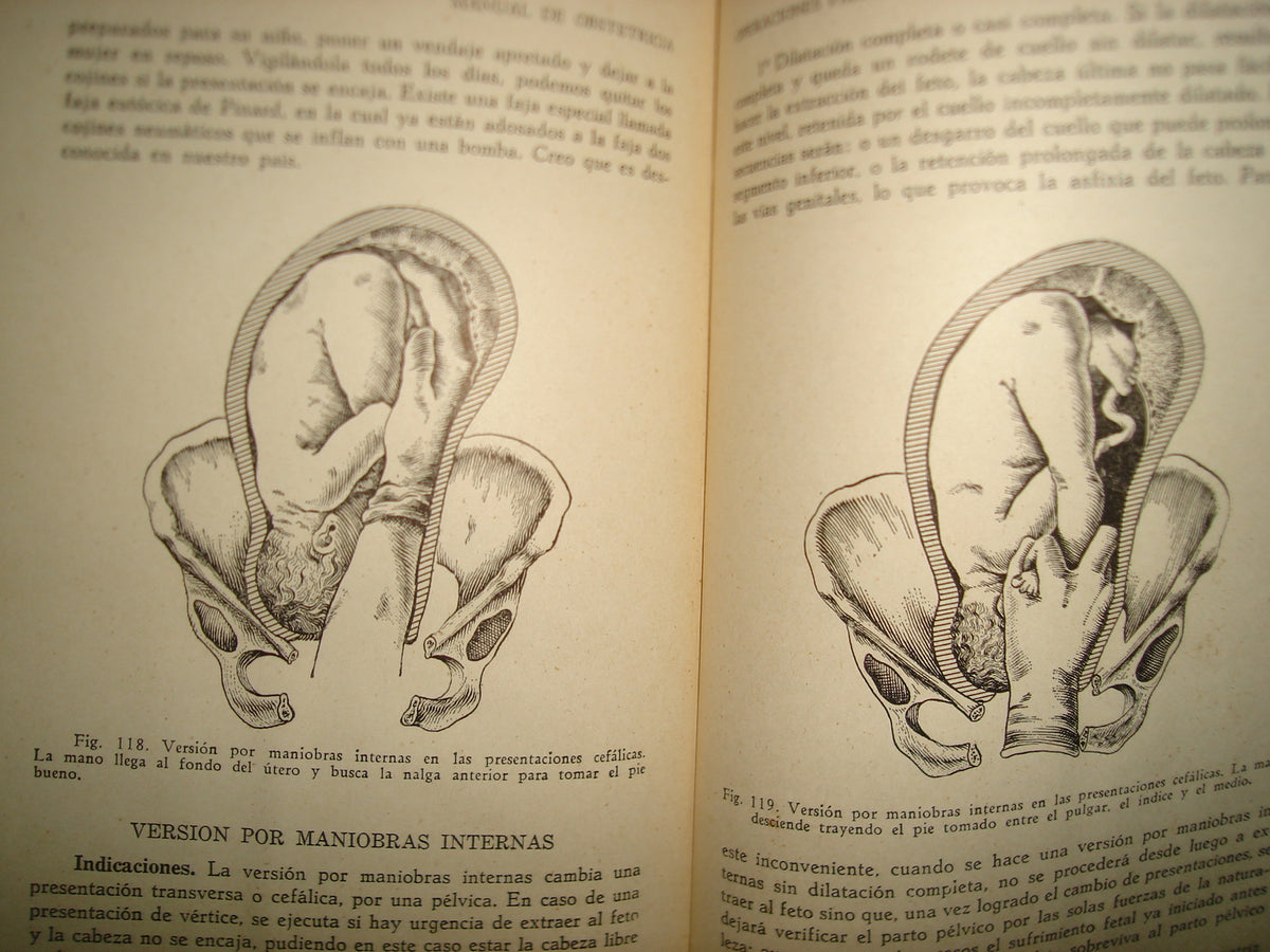 32- Manual De Obstetricia - José Rábago - 1965