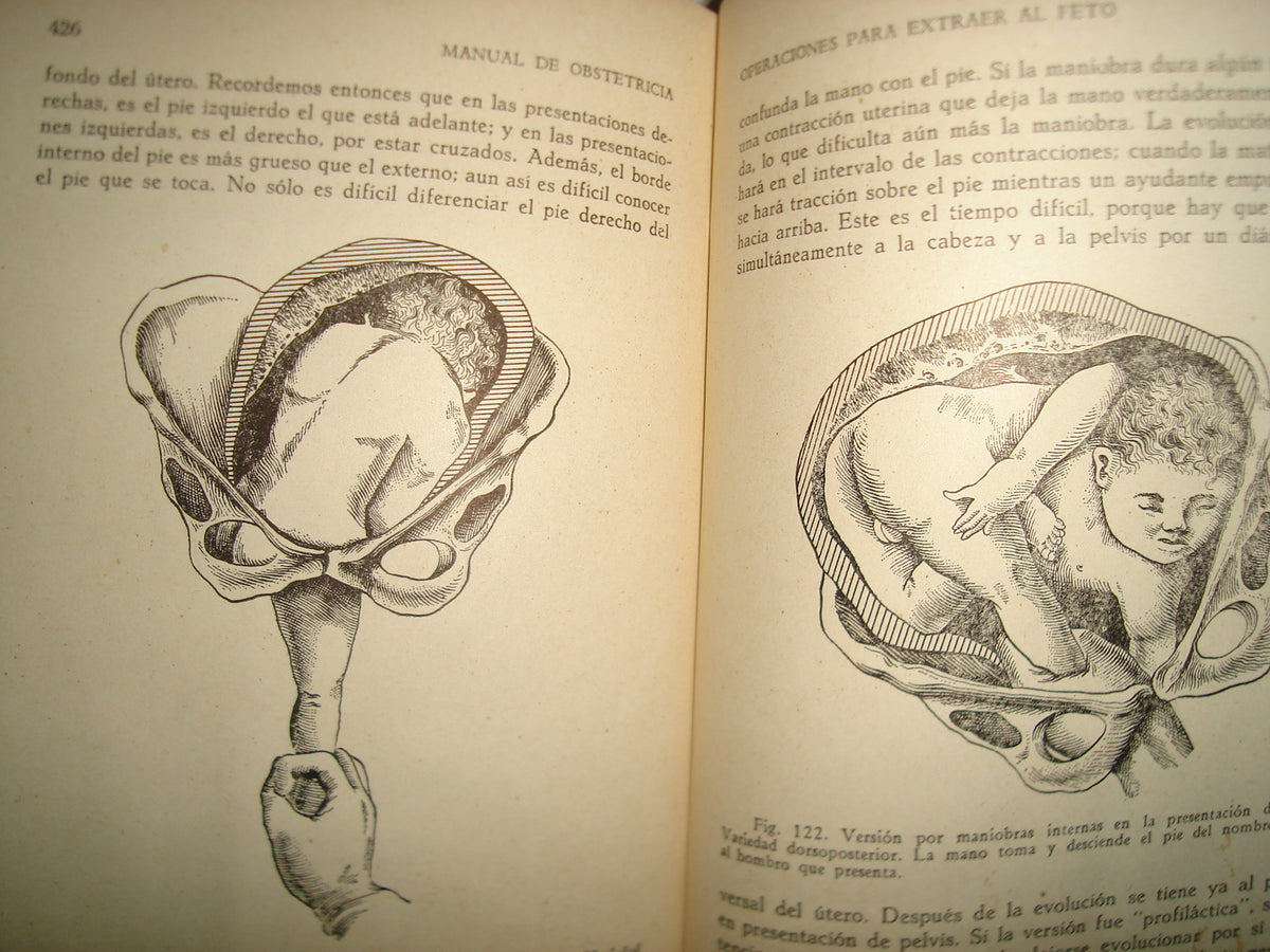 32- Manual De Obstetricia - José Rábago - 1965