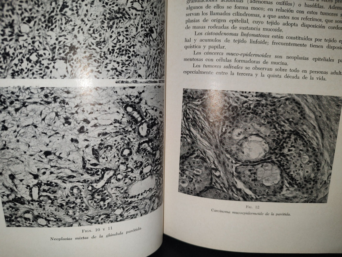 173- Manual De Cancerología Básica - Secretaría De Salubridad Y Asistencia - México 1963