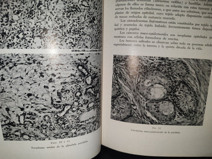 173- Manual De Cancerología Básica - Secretaría De Salubridad Y Asistencia - México 1963
