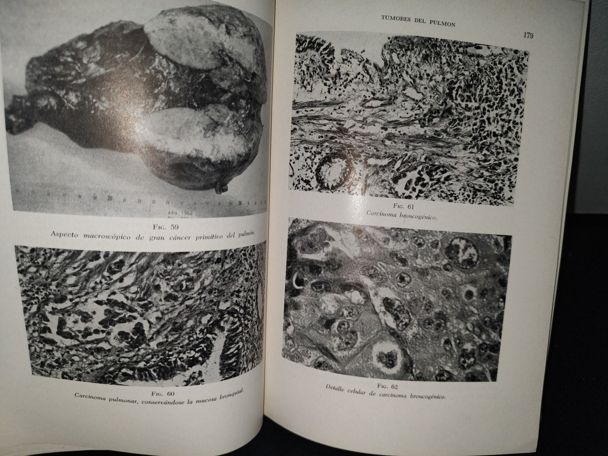 173- Manual De Cancerología Básica - Secretaría De Salubridad Y Asistencia - México 1963