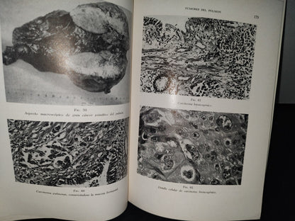 173- Manual De Cancerología Básica - Secretaría De Salubridad Y Asistencia - México 1963