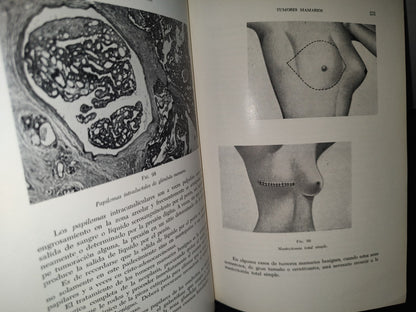 173- Manual De Cancerología Básica - Secretaría De Salubridad Y Asistencia - México 1963