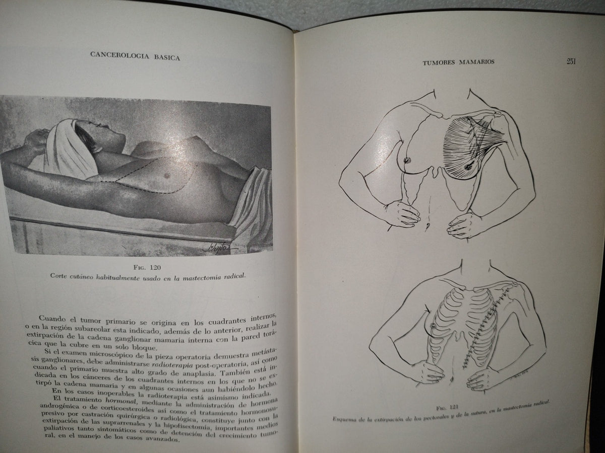 173- Manual De Cancerología Básica - Secretaría De Salubridad Y Asistencia - México 1963