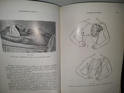 173- Manual De Cancerología Básica - Secretaría De Salubridad Y Asistencia - México 1963