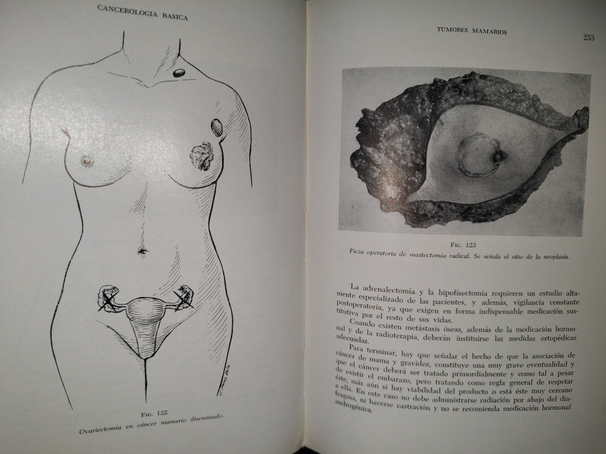 173- Manual De Cancerología Básica - Secretaría De Salubridad Y Asistencia - México 1963