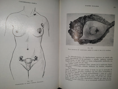 173- Manual De Cancerología Básica - Secretaría De Salubridad Y Asistencia - México 1963