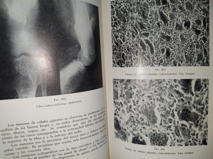 173- Manual De Cancerología Básica - Secretaría De Salubridad Y Asistencia - México 1963