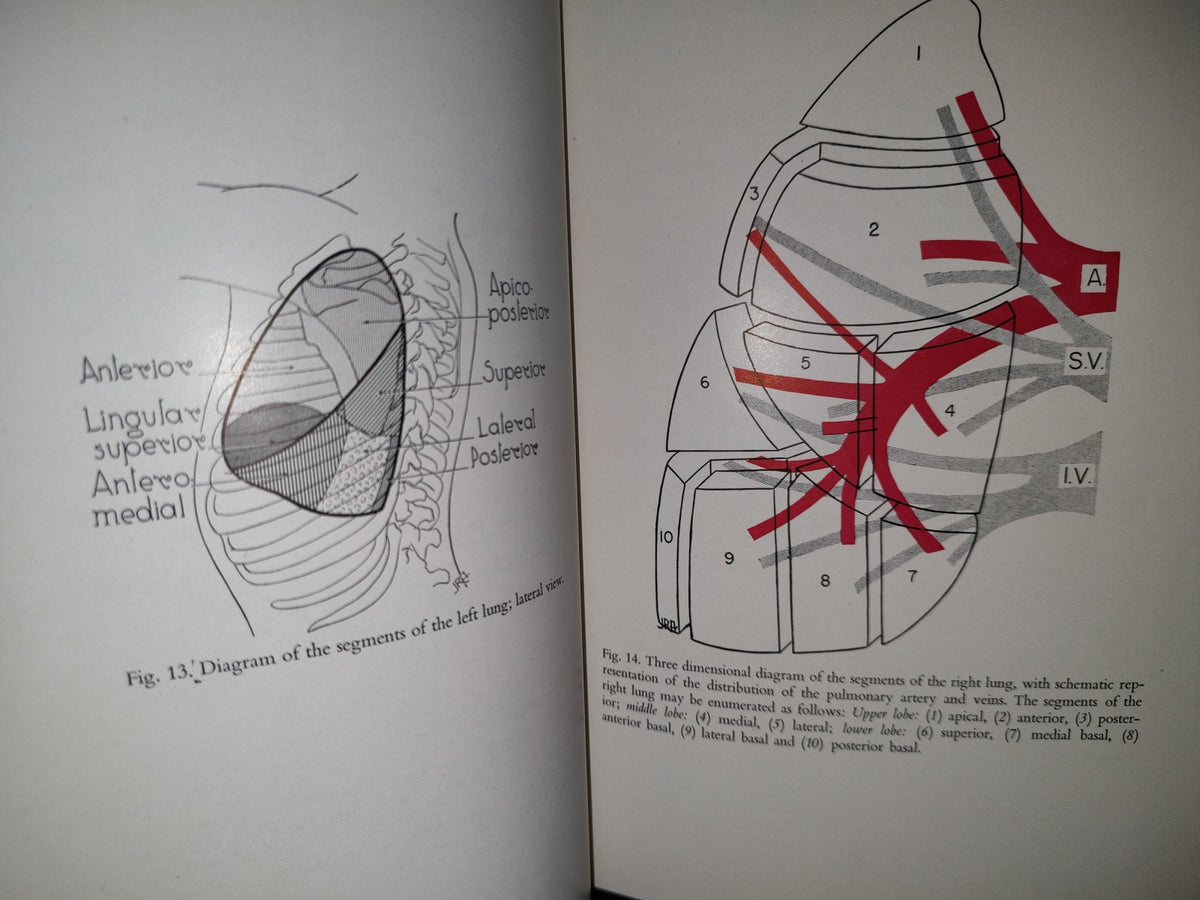 58- Inglés. Cirugía Del Tórax / Thoracic Surgery - Richard H. Sweet, M. D. - 1950