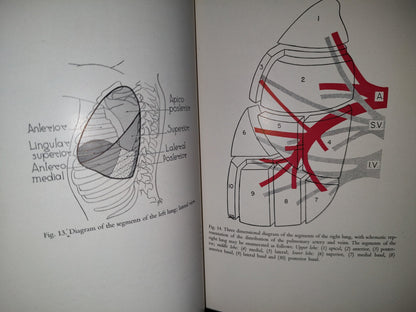 58- Inglés. Cirugía Del Tórax / Thoracic Surgery - Richard H. Sweet, M. D. - 1950