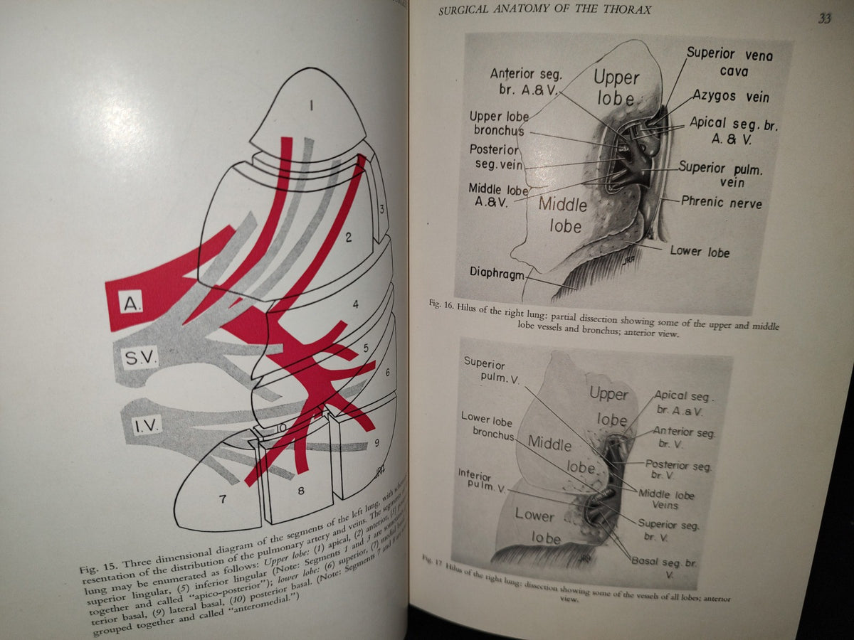 58- Inglés. Cirugía Del Tórax / Thoracic Surgery - Richard H. Sweet, M. D. - 1950