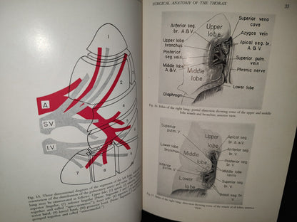 58- Inglés. Cirugía Del Tórax / Thoracic Surgery - Richard H. Sweet, M. D. - 1950