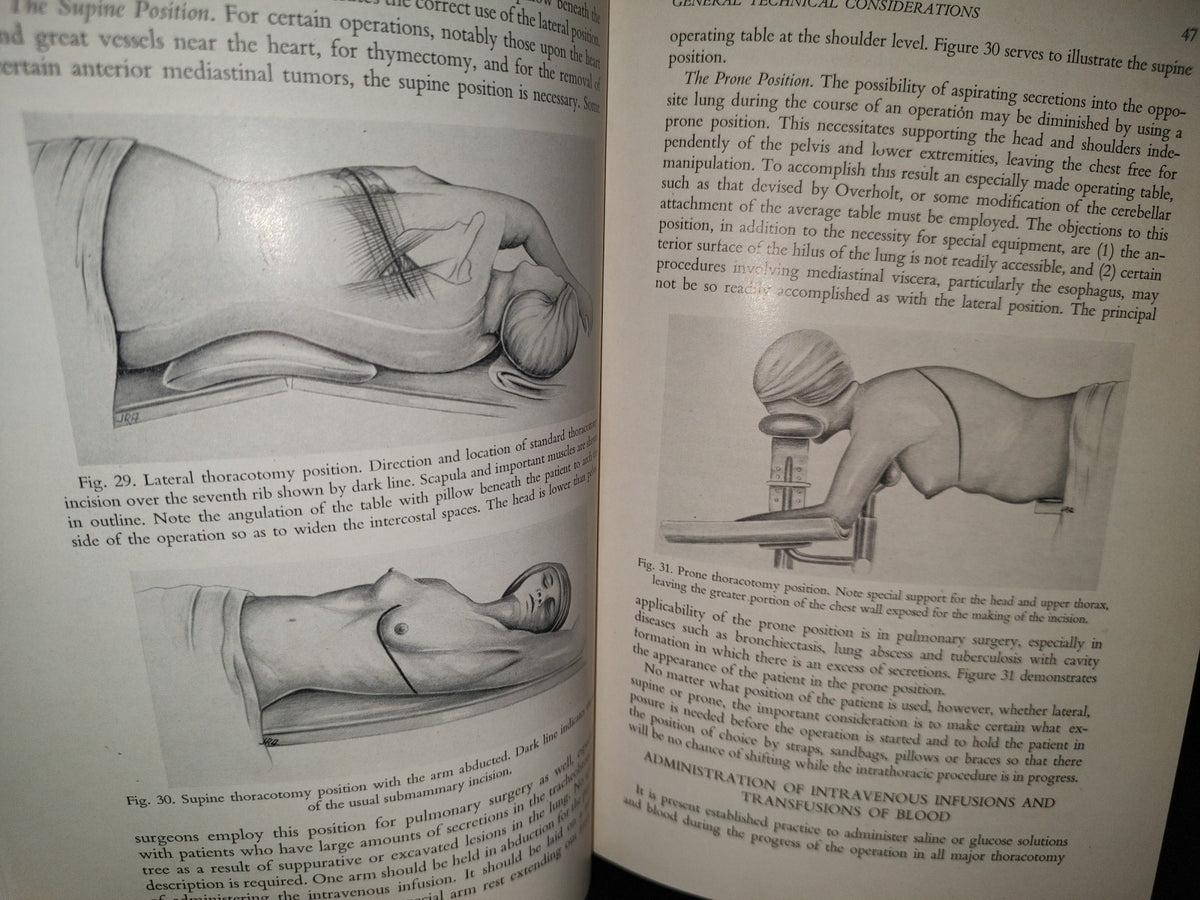 58- Inglés. Cirugía Del Tórax / Thoracic Surgery - Richard H. Sweet, M. D. - 1950