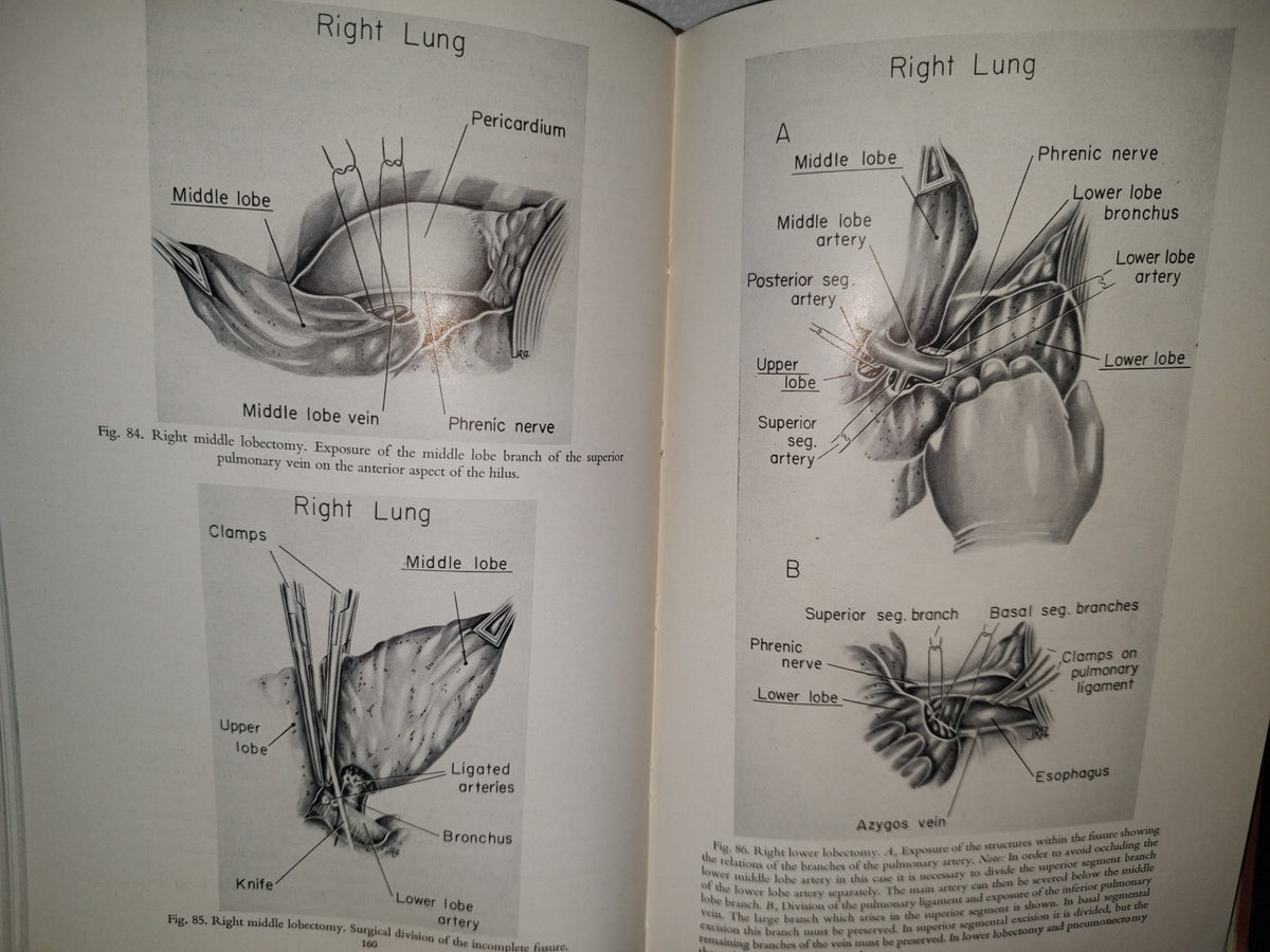 58- Inglés. Cirugía Del Tórax / Thoracic Surgery - Richard H. Sweet, M. D. - 1950