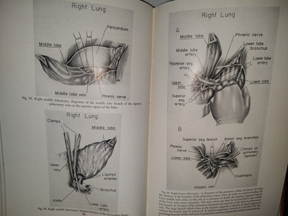 58- Inglés. Cirugía Del Tórax / Thoracic Surgery - Richard H. Sweet, M. D. - 1950