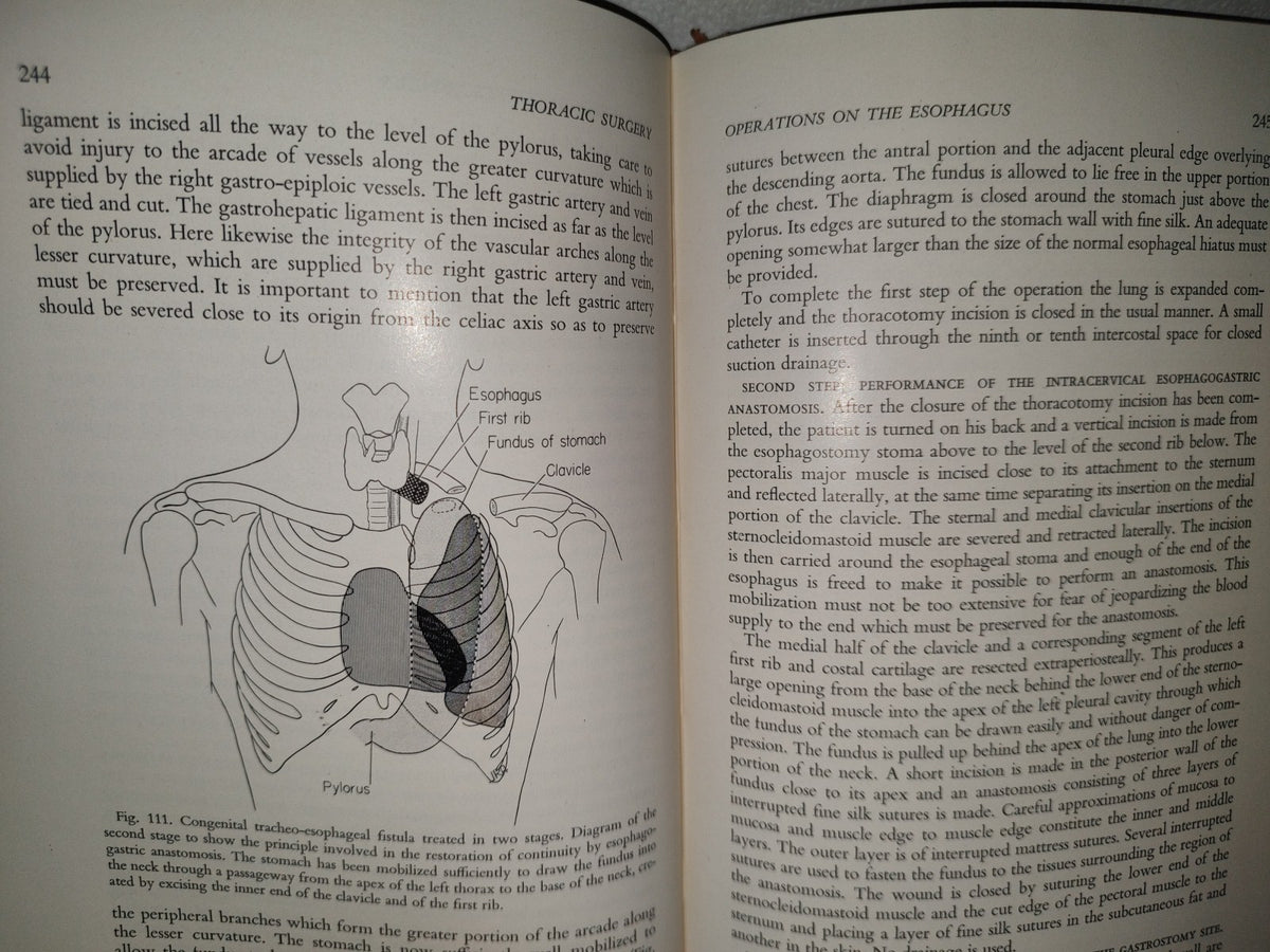 58- Inglés. Cirugía Del Tórax / Thoracic Surgery - Richard H. Sweet, M. D. - 1950
