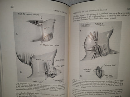 58- Inglés. Cirugía Del Tórax / Thoracic Surgery - Richard H. Sweet, M. D. - 1950