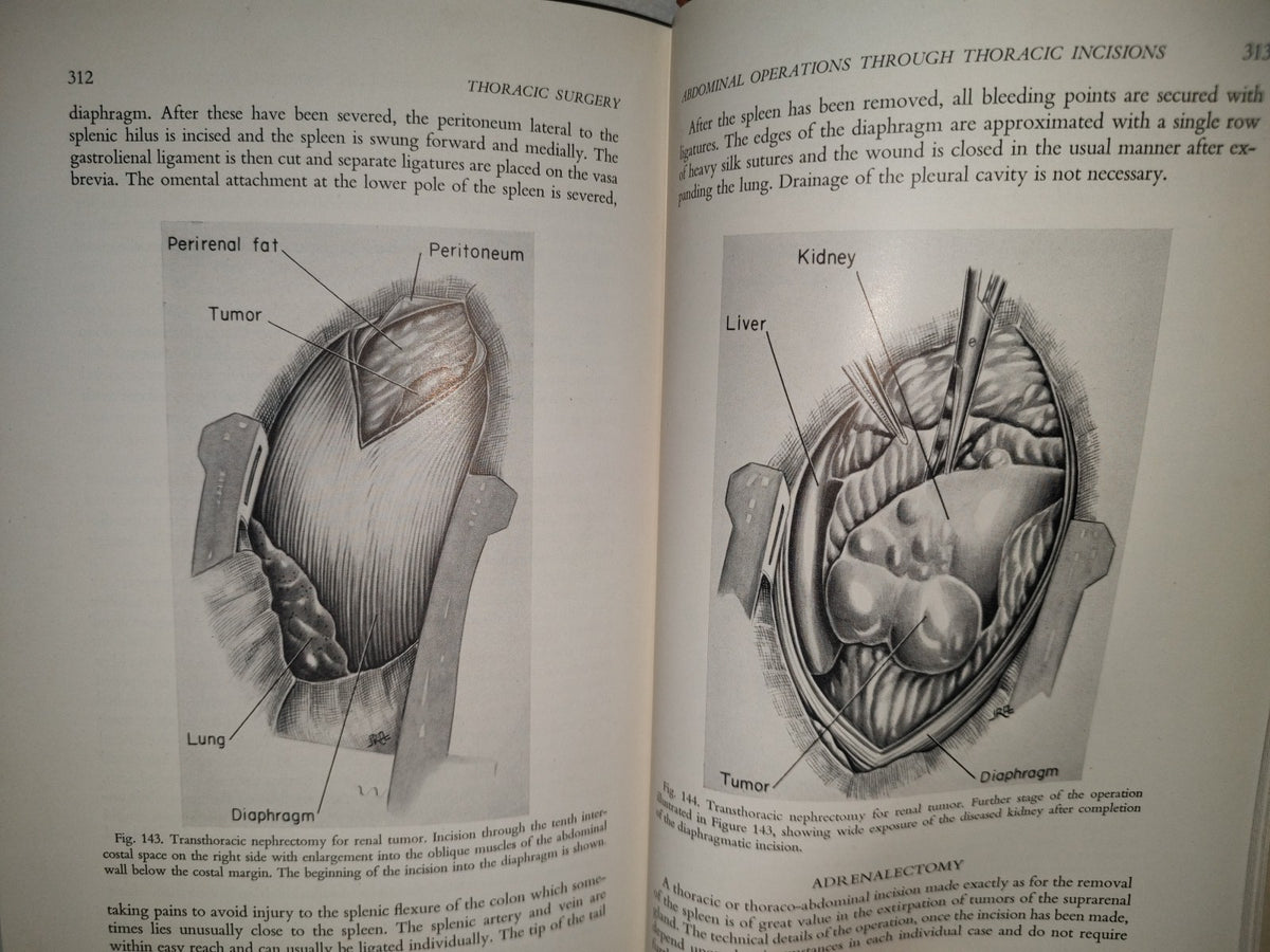 58- Inglés. Cirugía Del Tórax / Thoracic Surgery - Richard H. Sweet, M. D. - 1950