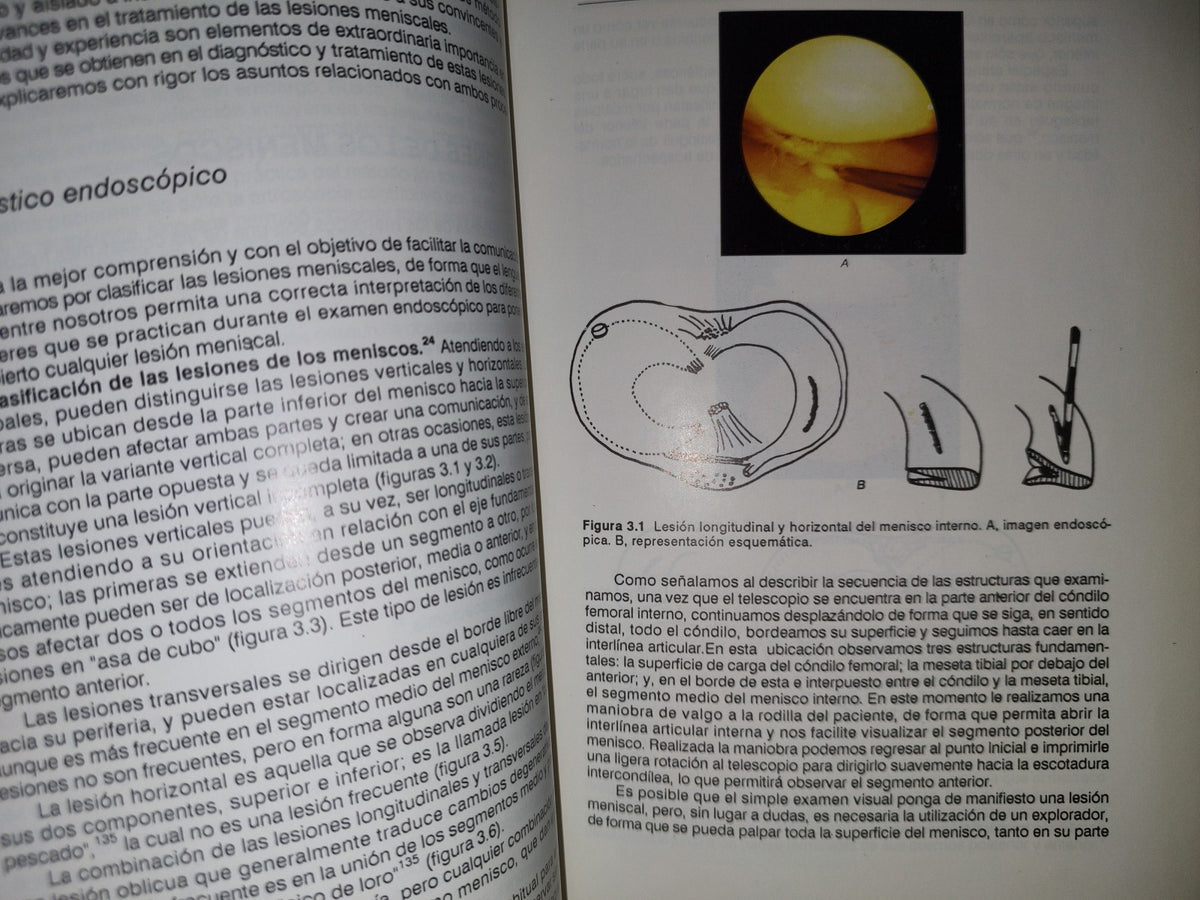 143- Artroscopia De La Rodilla. Experiencia De Un Reumatólogo - Jorge González Griego