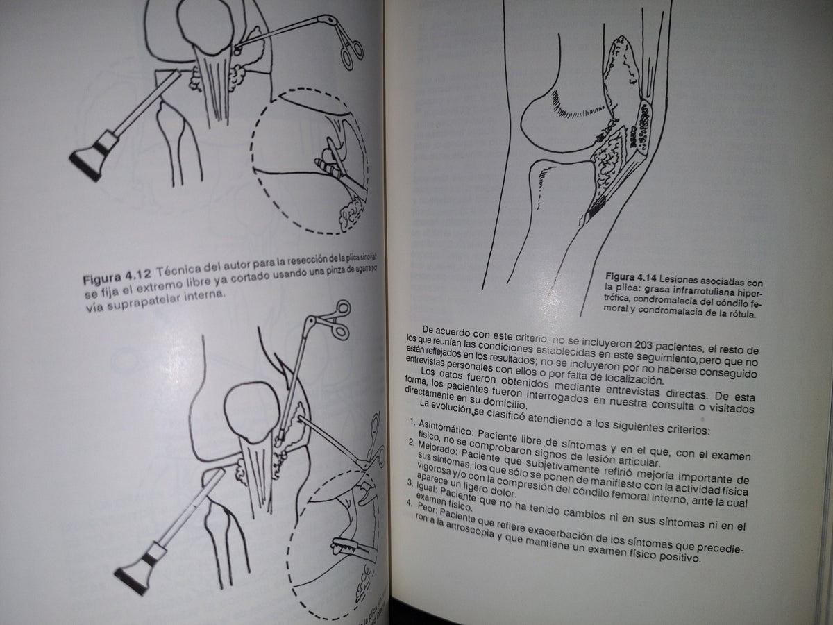 143- Artroscopia De La Rodilla. Experiencia De Un Reumatólogo - Jorge González Griego