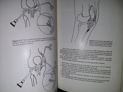 143- Artroscopia De La Rodilla. Experiencia De Un Reumatólogo - Jorge González Griego