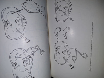 143- Artroscopia De La Rodilla. Experiencia De Un Reumatólogo - Jorge González Griego