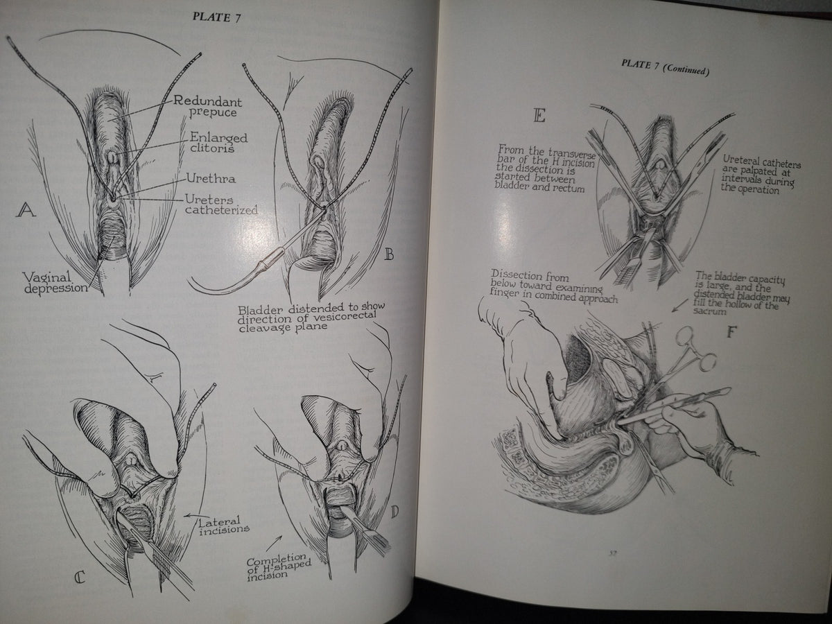 123- Cirugía Ginecológica Y Urología. Gynecologic Surgery And Urology - Thomas L. Ball - The Mosby Company - 1963