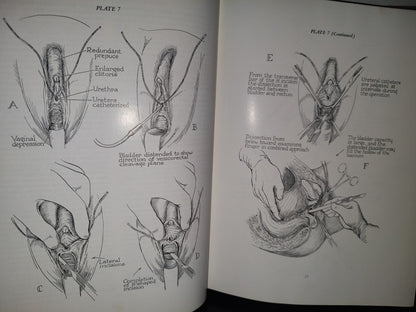 123- Cirugía Ginecológica Y Urología. Gynecologic Surgery And Urology - Thomas L. Ball - The Mosby Company - 1963