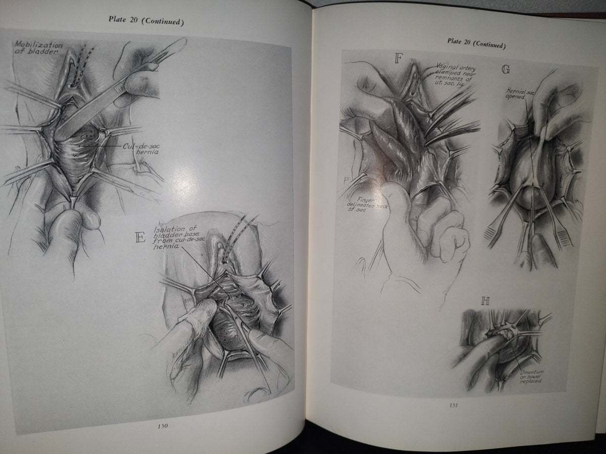 123- Cirugía Ginecológica Y Urología. Gynecologic Surgery And Urology - Thomas L. Ball - The Mosby Company - 1963