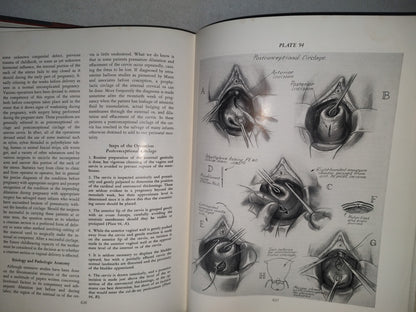 123- Cirugía Ginecológica Y Urología. Gynecologic Surgery And Urology - Thomas L. Ball - The Mosby Company - 1963