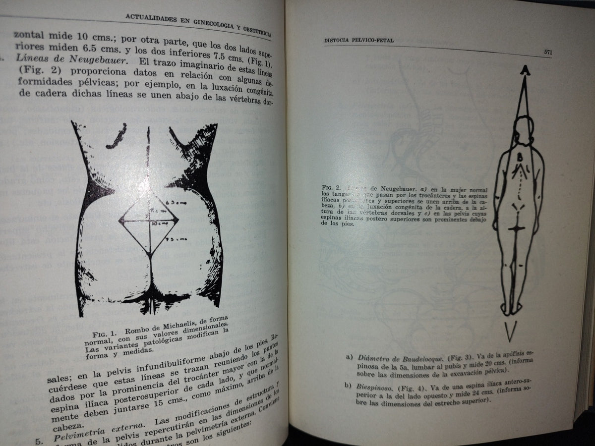 114- Actualidades En Ginecología Y Obstetricia - México 1970