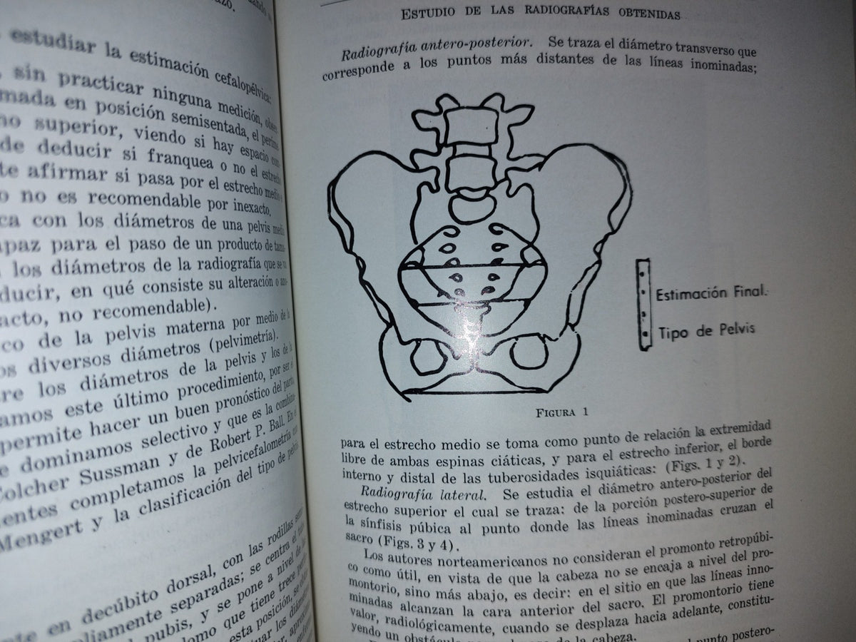 114- Actualidades En Ginecología Y Obstetricia - México 1970
