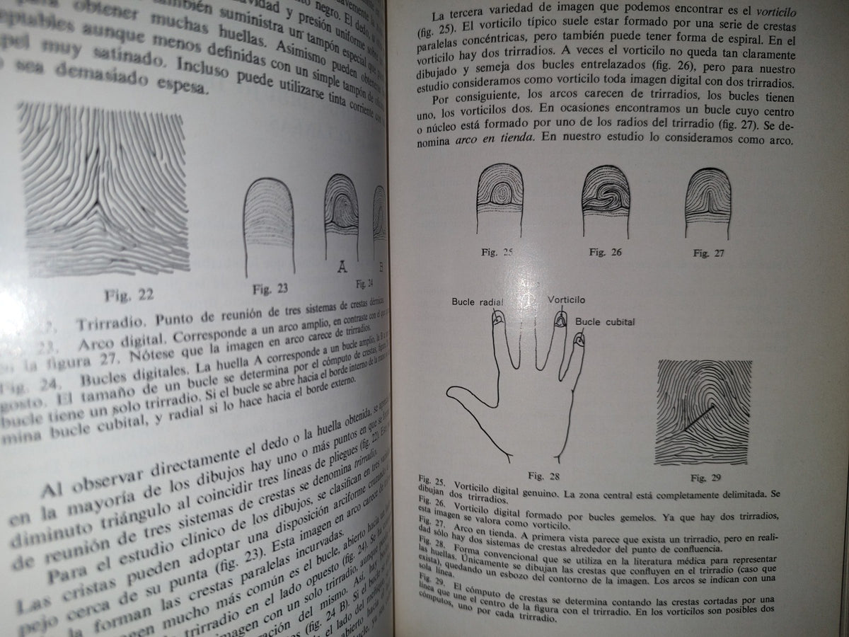 124- Trastornos Cromosómicos. Introducción Para El Clínico - G. H. Valentine