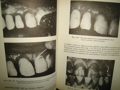 161- Manejo De Tejidos En Odontología Restaurativa - William F. P. Malone